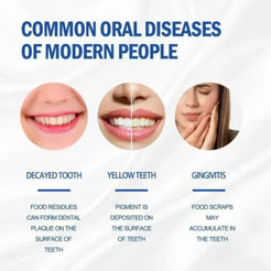 Sp-4 probiotic whitening toothpaste, Teeth Whitener Toothpaste, Natural Tooth Whitener (Buy One Get One Free)