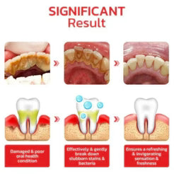 Sp-4 probiotic whitening toothpaste, Teeth Whitener Toothpaste, Natural Tooth Whitener (Buy One Get One Free)